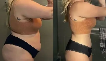 Testimonio 4, antes y después