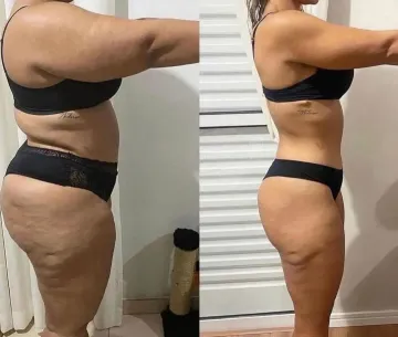 Testimonio 5, antes y después